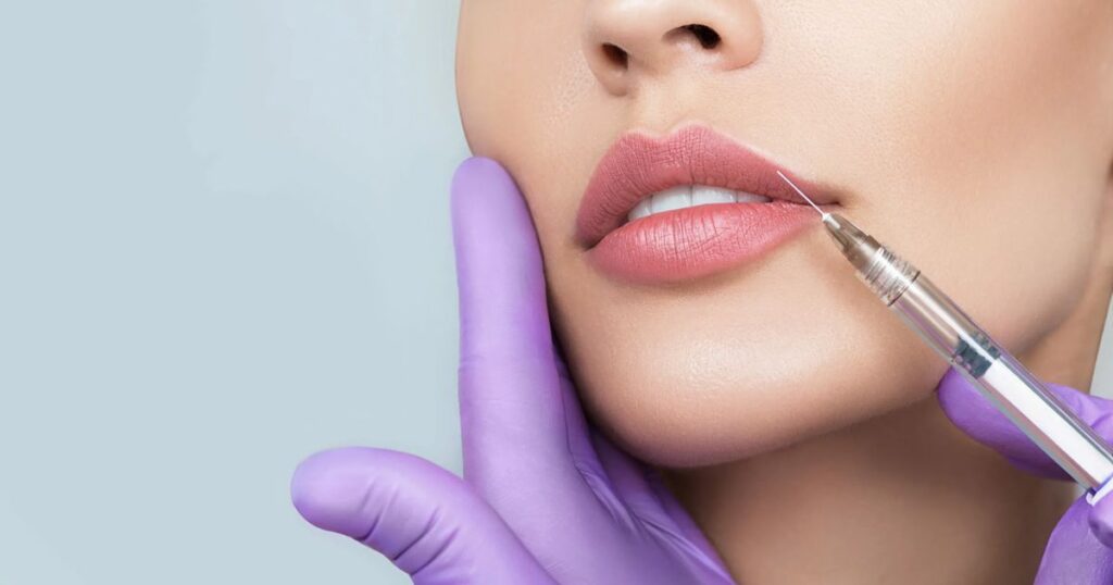 How Does Butterfly Lip Filler Work?
